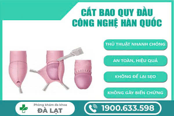 Hình ảnh minh họa
